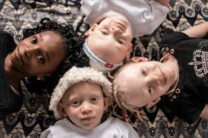 Почему родиться в Африке альбиносом — значит стать изгоем на всю жизнь