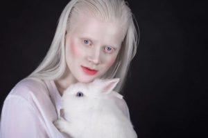 Люди-альбиносы: что вы о них не знали?