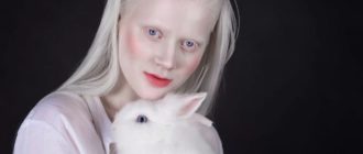 Люди альбиносы