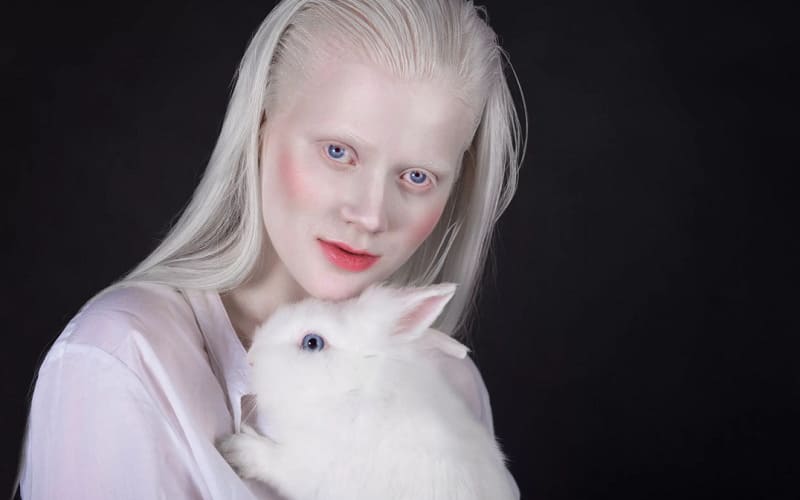 Люди альбиносы