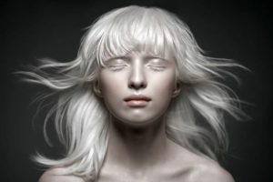 Модели-альбиносы, которые завоевали наши сердца